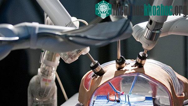 Robot phẫu thuật Mirosurge