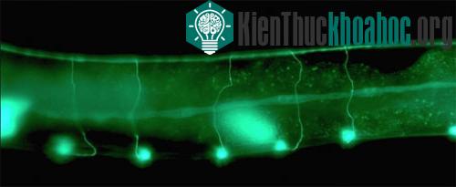 Caenorhabditis elegans được phát hiện sống thọ hơn trên quỹ đạo trái đất - (Ảnh: Wikipedia)