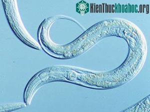 Giun Caenorhabditis elegans (C. elegans) - Ảnh: ac.uk.