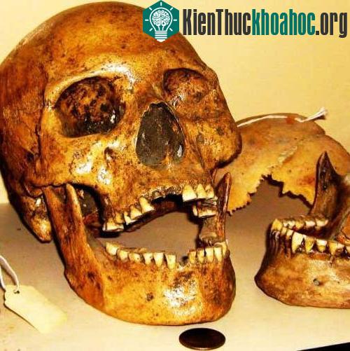 Đầu lâu người khổng lồ bên cạnh đầu lâu người thường ở Nhà bảo tàng Humboldt.
