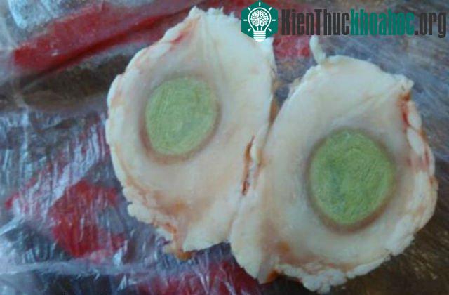 Cận cảnh dị vật mà anh Lý tìm thấy.