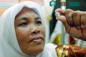 Kamariah đang xem viên pha lê - giống như viên ngọc lấy ra từ ngón&nbsp;chân&nbsp;của con gái cô.&nbsp;(Ảnh: nst.com.my)