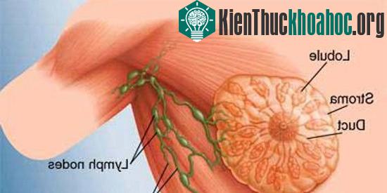 Ung thư vú - nỗi lo kinh hoàng của phụ nữ sẽ được tiêu diệt trong thế kỷ 21.