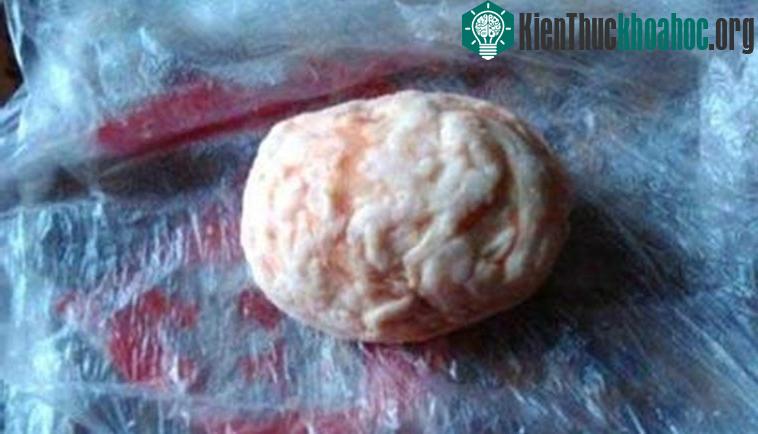 Dị vật có bề mặt sần sùi nhưng thơm nức mùi bơ.