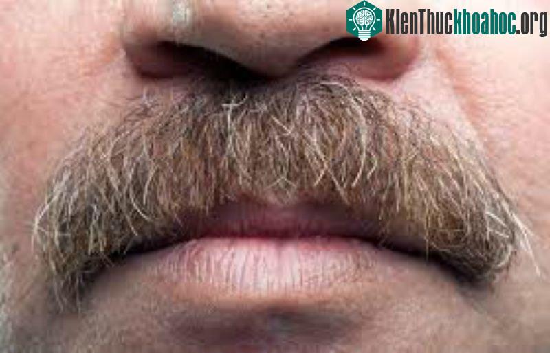 Vậy để được hôn thì trước hết hãy cắt ria mép đi đã!