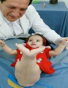 Bé Milagros Cerron&nbsp;(Ảnh: giareng)