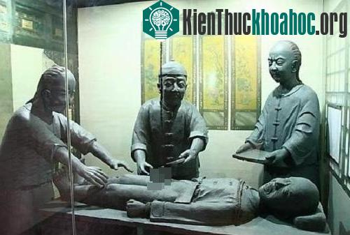 Tượng đá mô tả quá trình tịnh thân, hay còn gọi là cắt bỏ bộ phận sinh dục nam ở Trung Quốc. (Ảnh: Morning Post).