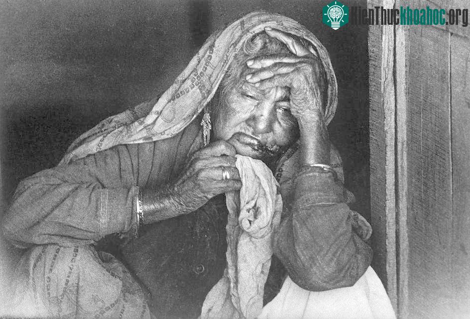 Vụ rò rỉ chất độc - Thảm án Bhopal