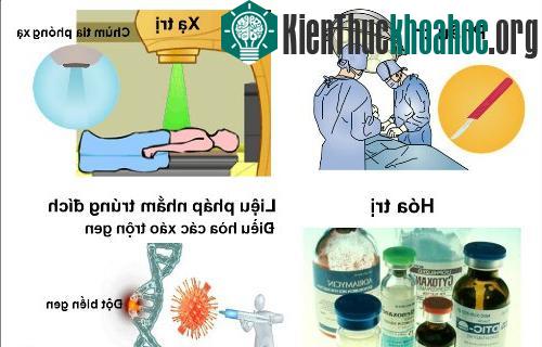 Các phương pháp điều trị ung thư.
