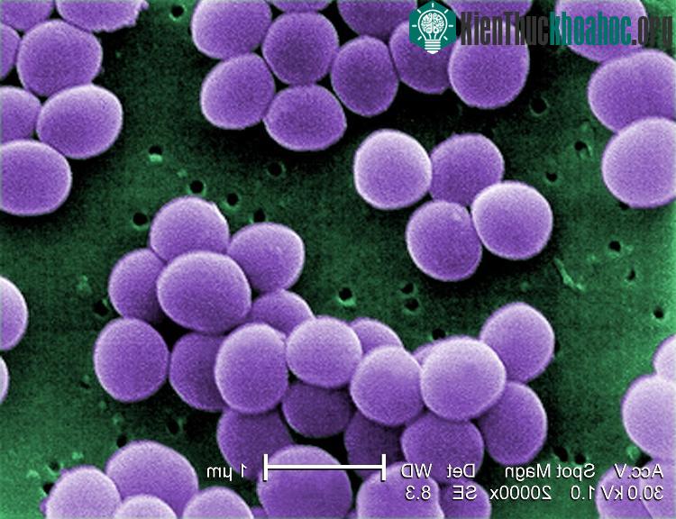 Ảnh chụp mô tả khuẩn Staphyloccocus Aureus.