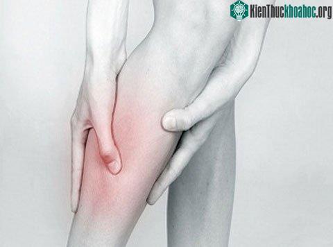 Chứng huyết khối tĩnh mạch