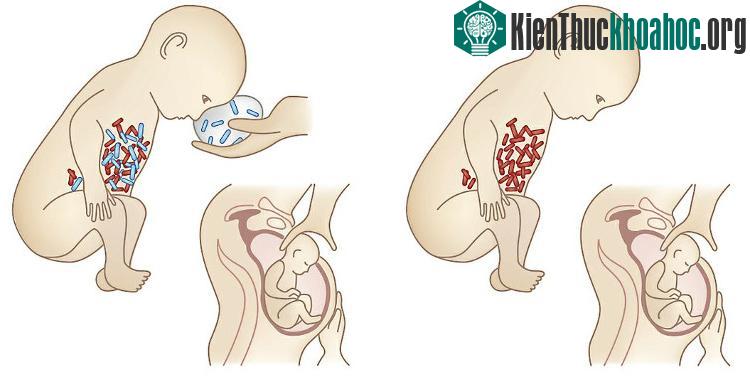 Để phát triển một hệ vi sinh vật đường ruột khỏe mạnh, trẻ cần được tiếp xúc với nhiều loài vi khuẩn đa dạng khác nhau.