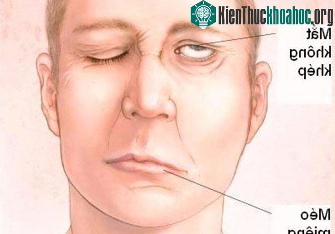 Theo giới chuyên gia, vào thời điểm giao mùa, thời tiết chuyển lạnh đột ngột thường khiến cơ thể không kịp thích nghi. (Ảnh minh họa).