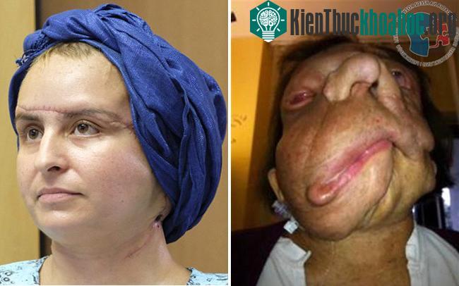 Sự thay đổi đáng kinh ngạc của Joanna.