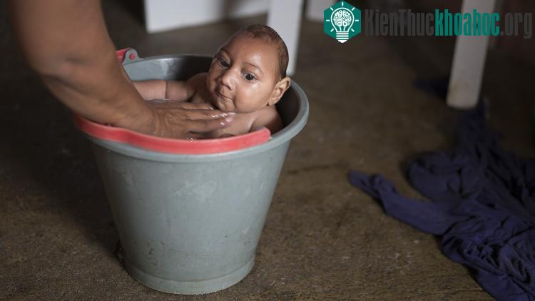 Biến chứng nguy hiểm của virus Zika là gây teo não và rối loạn hệ thống miễn dịch tác động đến thần kinh.