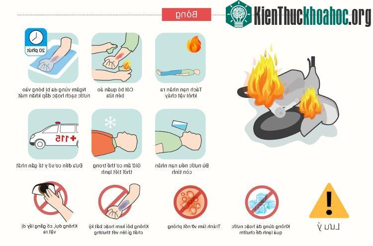 Khi bị bỏng, cần tách nạn nhân ra khỏi vật cháy, cởi bỏ đi quần áo bén lửa.