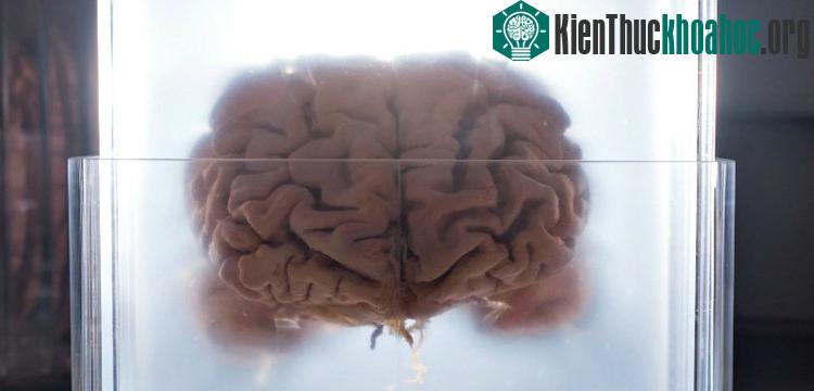 Kích thước não lớn dễ mắc bệnh thần kinh do tín hiệu thần kinh di chuyển với quãng đường xa hơn so với những loài có não nhỏ.