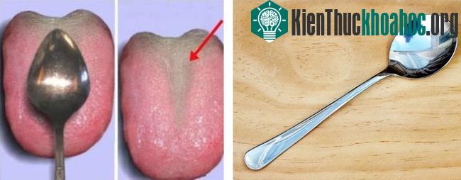 Lưỡi khỏe mạnh thì gần như không có mảng bám trên lưỡi và ngược lại mảng bám dày.