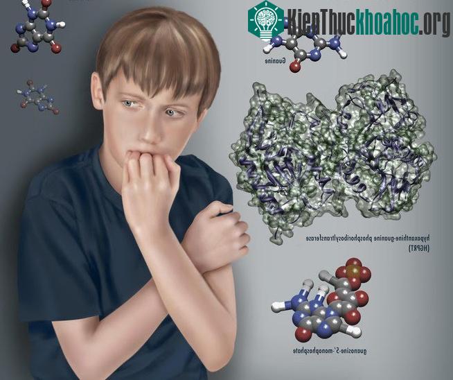 Các bác sỹ vẫn chưa hiểu hết được căn bệnh bí ẩn này sau vài thập kỷ tìm ra nó.