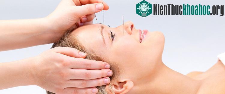Nếu bạn thấy xuất hiện các dấu hiệu của bệnh viêm dây thần kinh số 7 thì cần tìm đến bác sĩ châm cứu có chuyên môn sâu. (Ảnh minh họa).