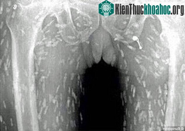Ăn việc ăn đồ sống hoặc đồ nấu chưa chín có thể khiến cơ thể nhiễm nhiều loại giun, sán.