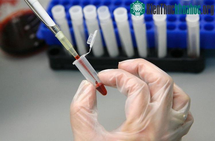 Đường máu là con đường lây truyền HIV nhanh nhất. (Ảnh minh họa: REUTERS).