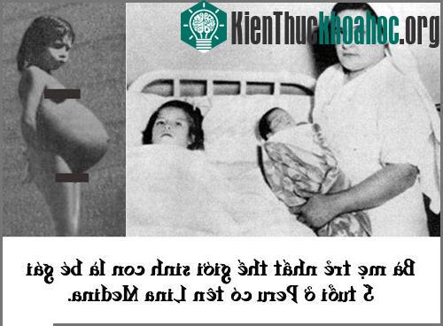 Bà mẹ trẻ nhất thế giới sinh con khi 5 tuổi