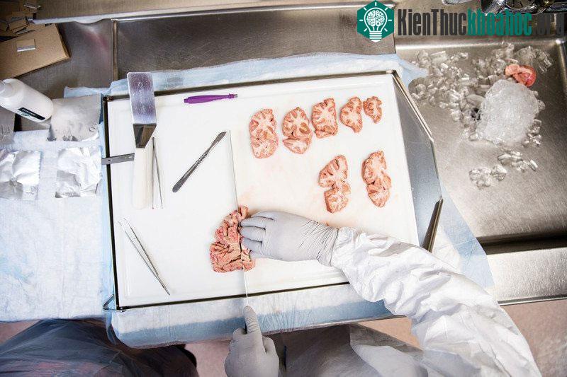 Thời gian trung bình để vận chuyển bộ não tới trung tâm ở bệnh viện McLean Hospital, Massachusetts, Mỹ là 17 tiếng.
