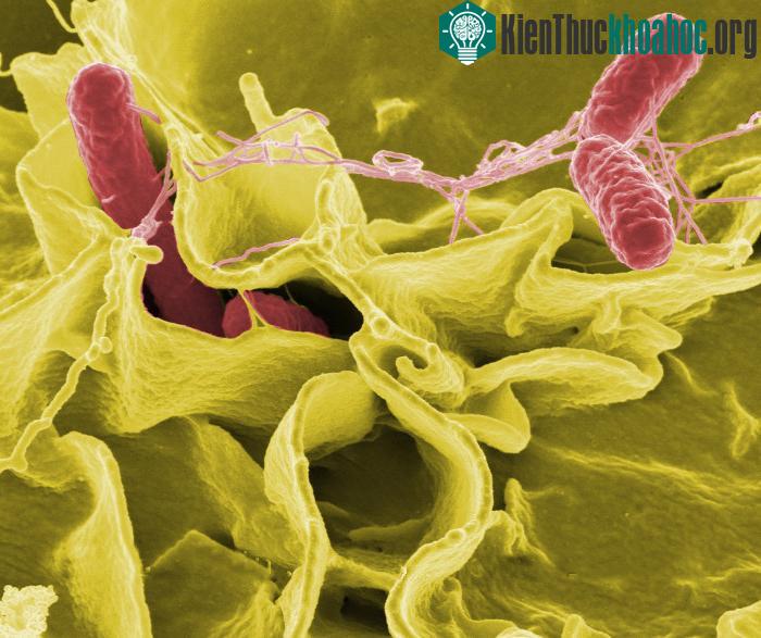 Chẩn đoán Salmonella hiên nay có thể mất tới 3 đến 5 ngày.