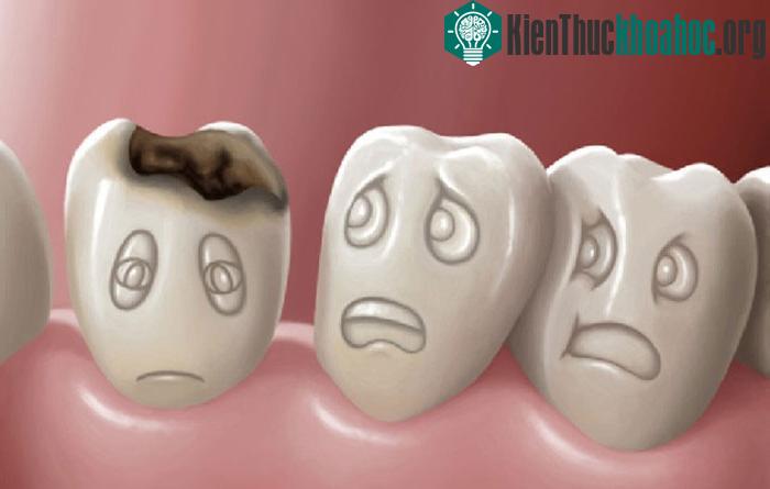 Hàm của bạn sẽ bị đau sau khi phải giữ mở liên tục trong vòng 20 phút, và đây là nỗi đau duy nhất mà bạn sẽ cảm thấy.