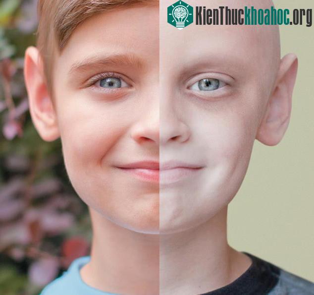 Nam giới không cảnh giác với những triệu chứng của ung thư