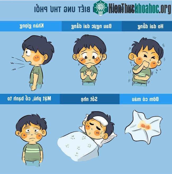 Một số dấu hiệu của ung thư phổi như: ho dai dẳng, đờm có máu, sốt nhẹ, khàn giọng, đau ngực dai dẳng...
