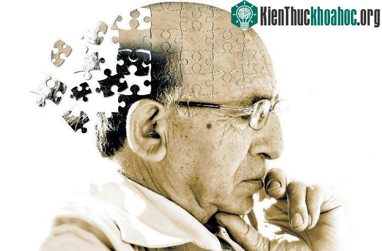 Các nhà khoa học phải mất 15 năm hoặc lâu hơn nữa mới có thể tạo ra được loại thuốc điều trị chứng mất trí nhớ ở người.