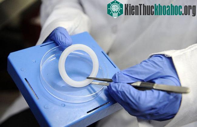 Chiếc vòng "thần thánh" này có thể làm giảm nguy cơ nhiễm HIV tới 56%