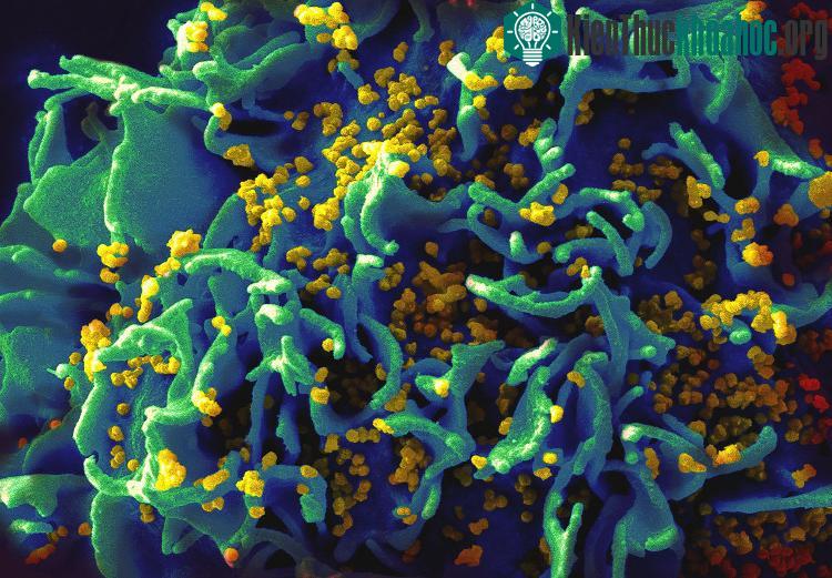 Úc đã tham gia vào số ít các quốc gia kiểm soát thành công căn bệnh AIDS.