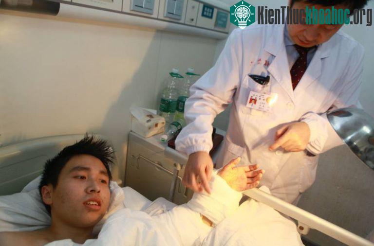 Sau khi được phẫu thuật cấy ghép hoàn lại bàn tay.