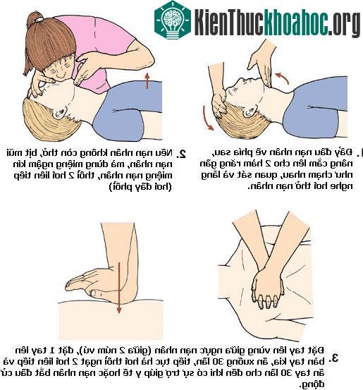 Cấp cứu thổi ngạt - ấn tim