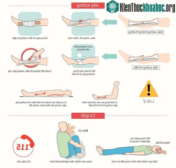Nên đặt nạn nhân nằm trên vùng đất an toàn nếu nạn nhân bị co giật.