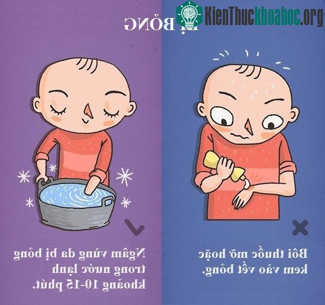 Ngâm khu vực bị bỏng trong nước lạnh khoảng 15 phút để giảm nhiệt độ.