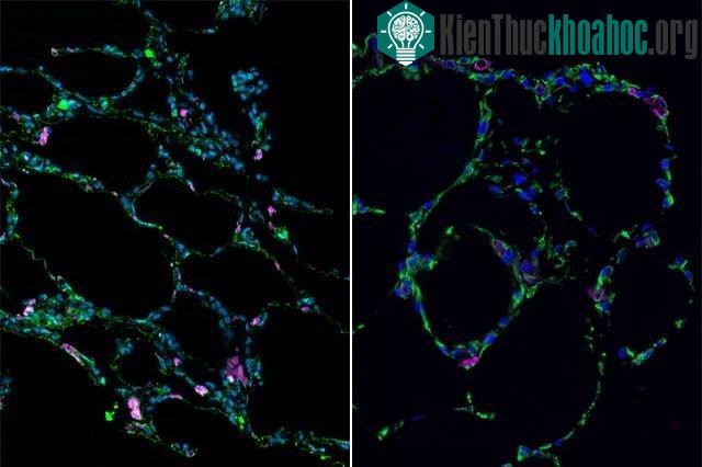 Mặt cắt ngang của mô phổi dưới kính hiển vi. (Ảnh: UCLA Broad Stem Cell Research Center).