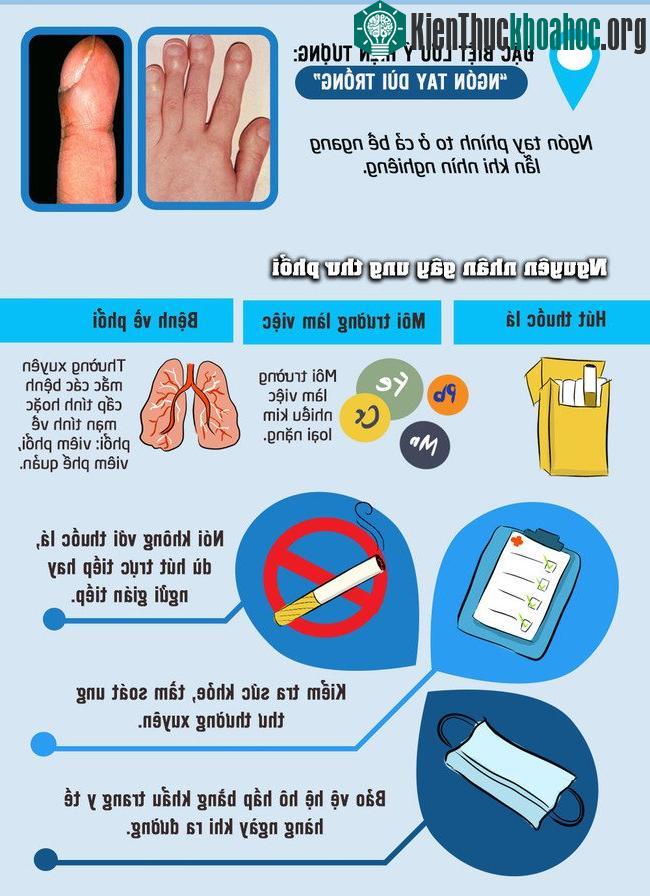 Nguyên nhân gây ra ung thư phổi gồm có: hút thuốc lá, môi trường làm việc nhiều kim loại nặng hoặc mắc bệnh về phổi.