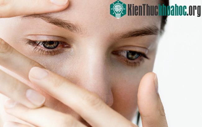 Mí mắt nhợt nhạt