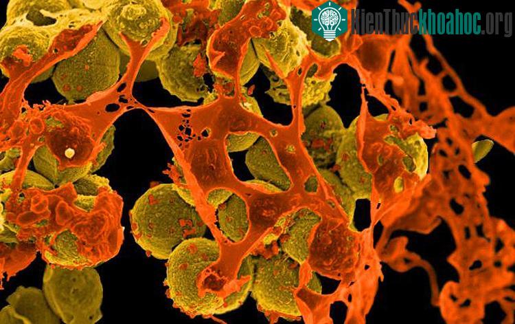 Ảnh hiển vi cho thấy các khuẩn MRSA đang bị bao quanh bởi các mảnh tế bào.