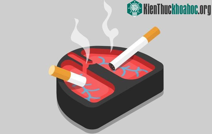 Thuốc lá gây bệnh phổi tắc nghẽn mãn tính.