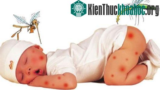 Cho trẻ nằm màn mỗi khi đi ngủ để phòng tránh muỗi đốt. (Ảnh minh họa)