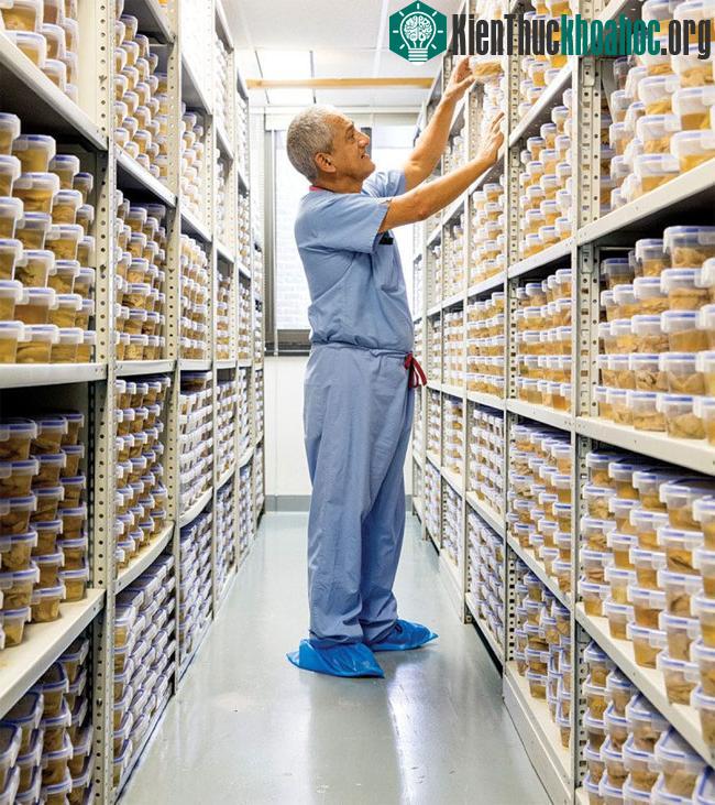 Một bán cầu não được cắt thành nhiều lát từ trước ra sau với những cấu trúc quan trọng được gỡ bằng dao mổ.