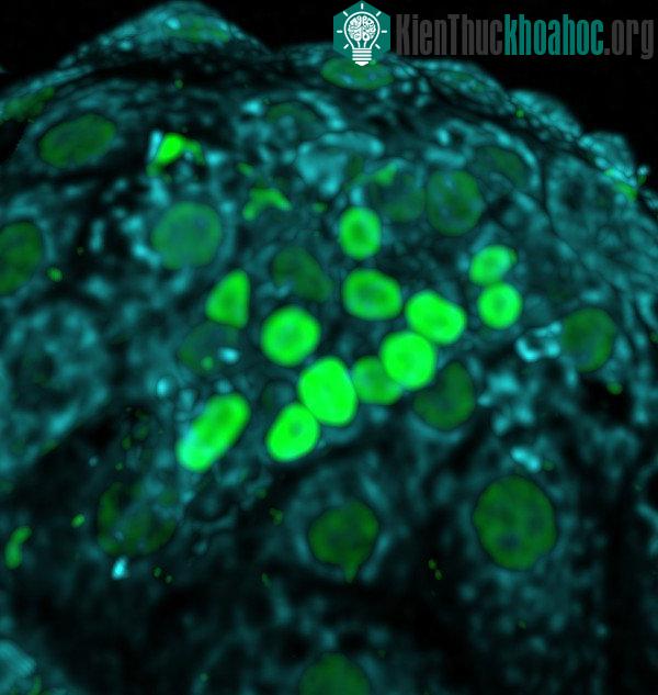 Quá trình phát triển của phôi thai trong tử cung người mẹ. (Ảnh: Brivanlou lab/Nature).