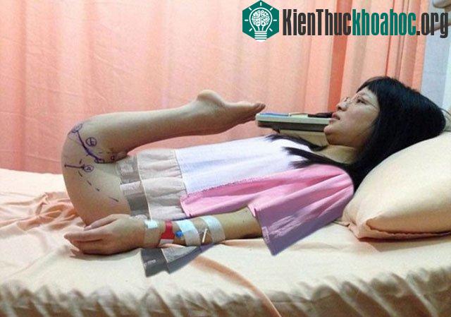 Chen Tuanzhi trước phẫu thuật...