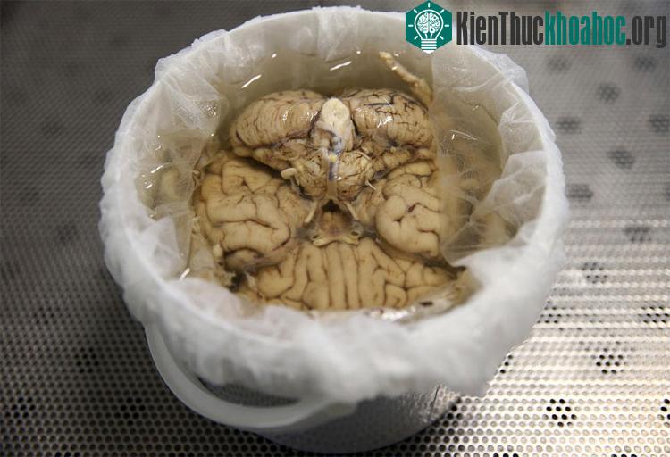 Bán cầu não còn lại được nhúng vào formalin trong vài tuần trước khi chuyển cho một nhà phân tích bệnh học mổ xẻ