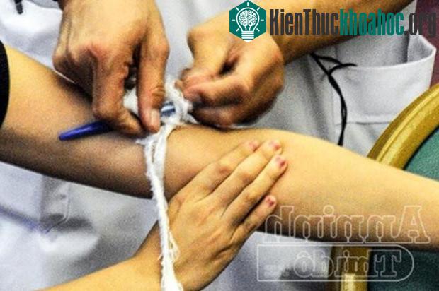 Nếu trong trường hợp sau khi bịt miệng vết thương bằng băng gạc mà không giảm được tình trạng chảy máu thì tiến hành buộc garo phía trên vết thương.